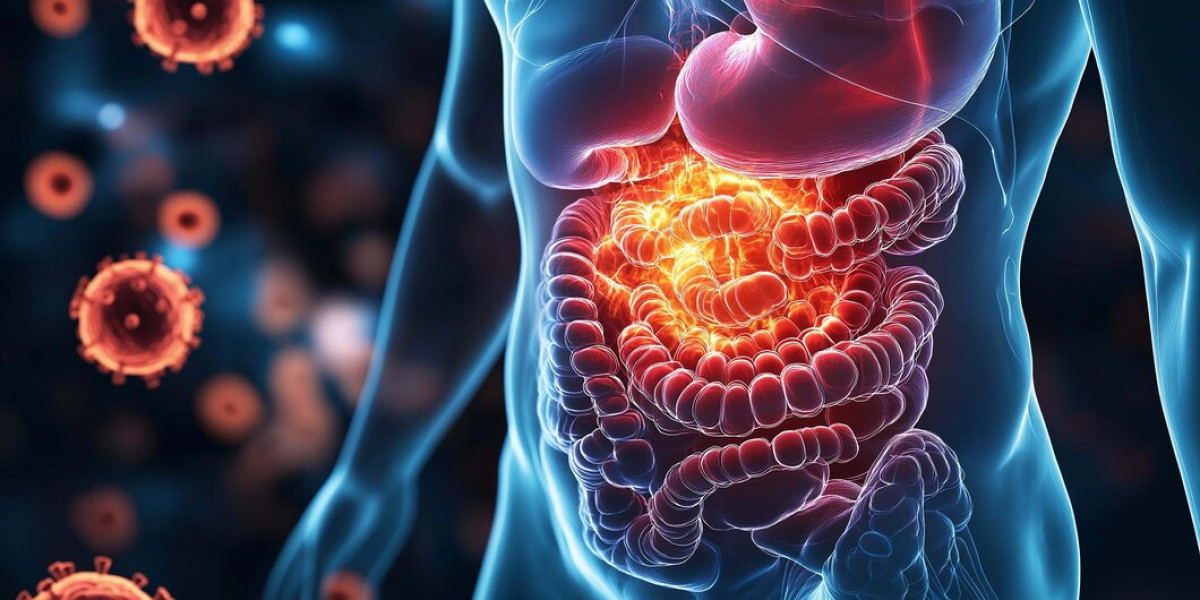 Why Triclabendazole Is the Choice for Fascioliasis?